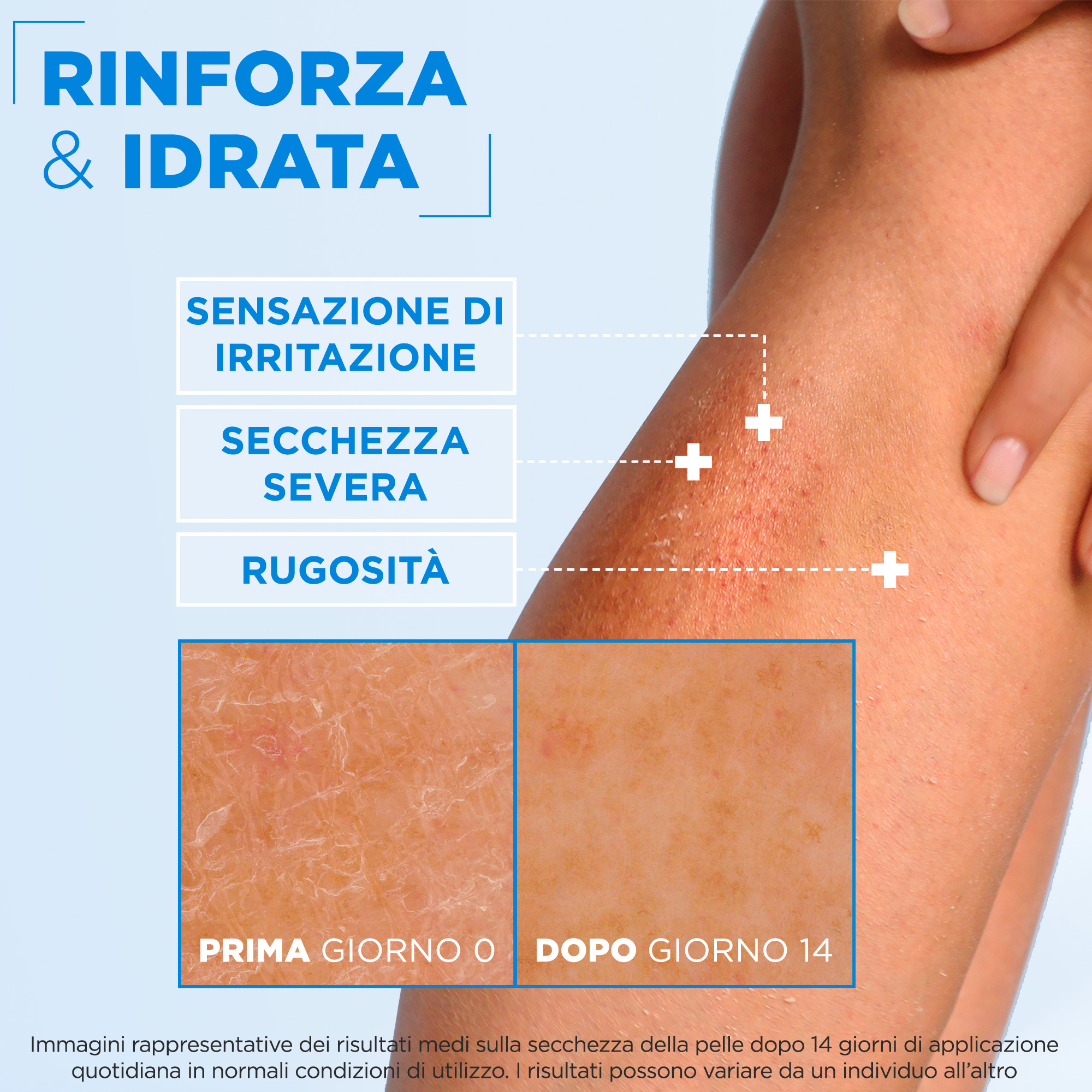 L'immagine mostra un confronto dell'efficacia di un prodotto idratante sulla pelle, con l'etichetta
